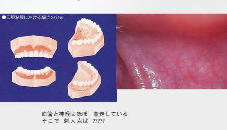 口腔粘膜における痛点の分布
